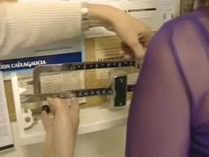 Una jueza de Ferrol ordena alimentar a una enferma de anorexia por vía parental