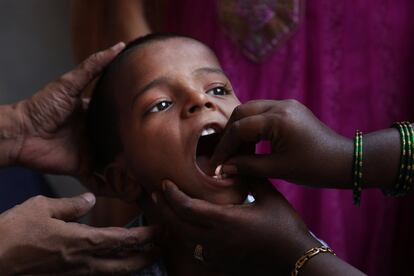 Un pequeño toma una pastilla en Hyderabad dentro de la campaña de desparasitación dirigida a 270 millones de niños de India.