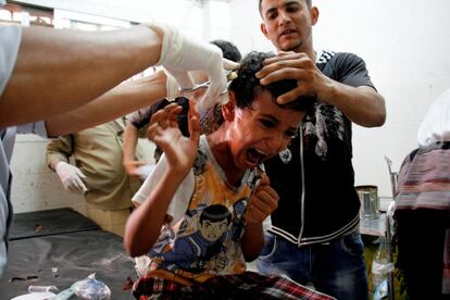 Un niño es atendido en el hospital tras ser herido en el fuego cruzado en Taiz (Yemen), el 2 de junio de 2017.