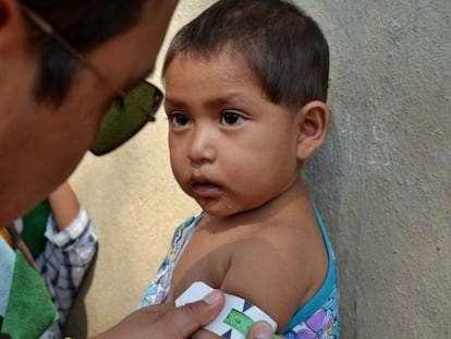 Un control de desnutrición infantil.