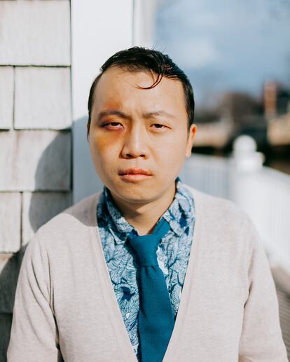 ‘Tourist (Black Eye), Southport, Connecticut’ (2016), del libro ‘Tommy Kha: Half, Full, Quarter’, publicado por Aperture (2023).