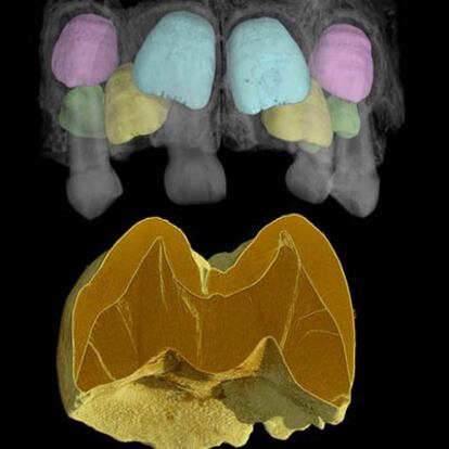 Tomografía de una mandíbula neandertal.