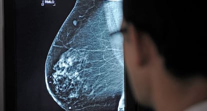 Un médico observa una mamografía en el hospital Virgen del Rocío de Sevilla.