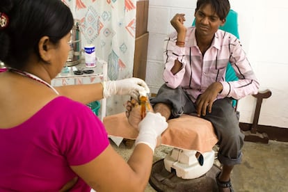Según el equipo médico del hospital, cinco o seis son nuevos casos de lepra son detectados cada día. Esto eleva la cifra a 2.000 nuevos leprosos cada año.