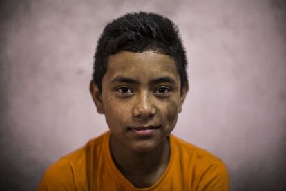 Manoj Tamang, de 15 años, es primo de Radha. Era el menor de tres hermanos. El mayor tenía fama por bailar en las calles y otro chico lo asesinó de una puñalada por celos. La madre no superó la muerte del hijo y empezó a beber mientras el padre vende fruta en la calle. La madre murió el pasado año.