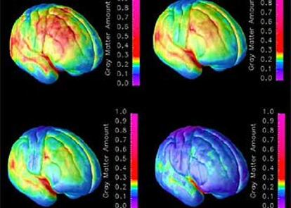 El raciocinio termina de desarrollarse en los primeros a?os de la edad adulta, segn los autores del estudio. En las fotos, el progreso de maduracin del cerebro.