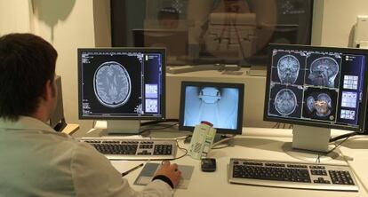 Escáner del Centro de Investigaciones y Terapias Avanzadas ( CITA- Alzhéimer) para el diagnóstico de pacientes.