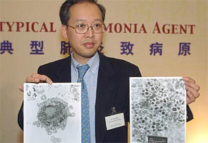 El biólogo Dominic Tsang muestra células infectadas por neumonía.
