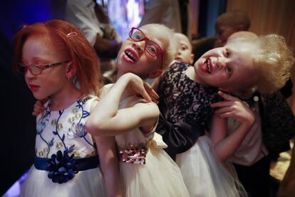 De izquierda a derecha, las niñas albinas Elsie Lynn, de seis años; Shirlyn, de de siete, y Rebecca Zawadi, de ocho, posan para un fotógrafo detrás del escenario antes de desfilar sobre la pasarela.
