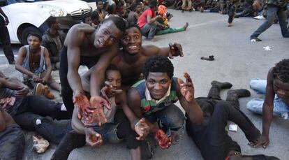 Migrants show their wounded hands after jumping the border fence.