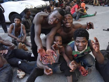 Migrants show their wounded hands after jumping the border fence.