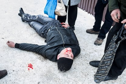 Este hombre sufrió un desmayo en el centro de Mirni. Los médicos encontraron una botella de vodka vacía dentro de su chaqueta (Mirni, 26 de marzo de 2018).