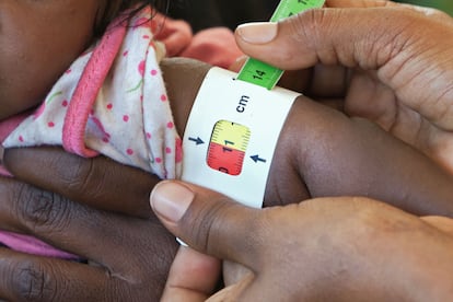 Un trabajador sanitario mide la circunferencia del brazo de un niño en Guyan (Etiopía) para determinar si está desnutrido.