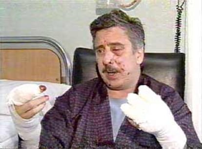 Gorka Landaburu, en el hospital, tras recibir un paquete bomba enviado por ETA en 2001.