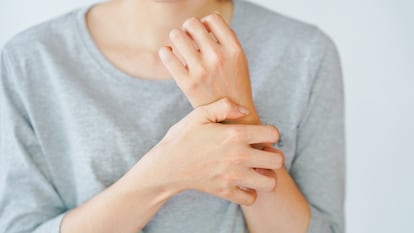 El síntoma más característico de la dermatitis atópica es el picor, tan intenso en ocasiones que el propio rascado puede generar lesiones cutáneas.