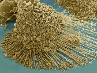 Imagen de c&eacute;lula cancer&iacute;gena obtenida por microscopio electr&oacute;nico.