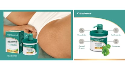O creme anti-estrias Trofolastin conquistará a Amazon na Black Friday 2025.