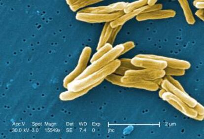 La &#039;Mycobacterium tuberculosis&#039; vista con un microscopio electr&oacute;nico.