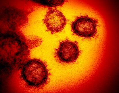 Imagen microscópica del virus SARS-CoV-2