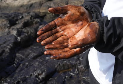 Un trabajador muestra sus manos manchadas de petróleo tras horas limpiando las playas de Ventanilla. 