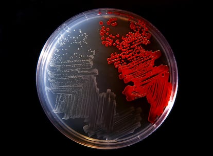 Un cultivo de bacterias en laboratorio.