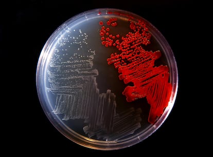 Cultivated bacteria in a laboratory.