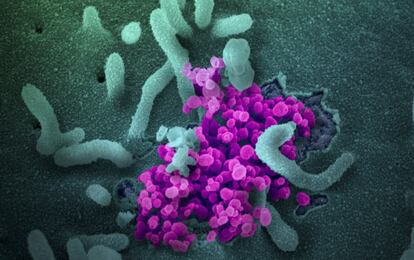 El virus del coronavirus al microscopio