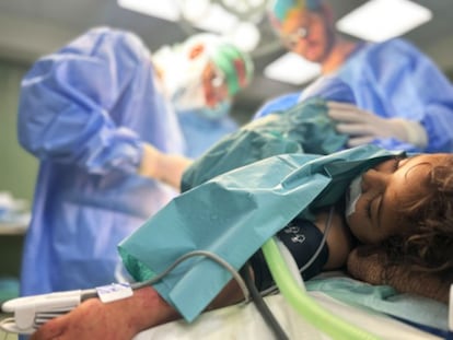 Cirujanos plásticos llevan a cabo una segunda cirugía reconstructiva sobre el cuerpo de Manal, de 3 años.