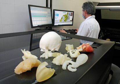 Una pionera impresora en tres dimensiones (3D) del centro tecnológico AIJU es capaz de recrear órganos vitales de un paciente.