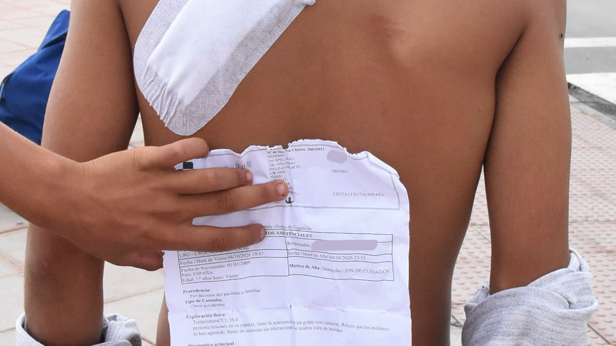 Hospital de ceuta remite a la justicia al menos 20 partes de lesiones de migrantes histórico, presuntamente causadas por militares. 3 El hospital de ceuta envía al juzgado al menos una veintena de partes de inmigrantes que atribuyen sus lesiones a militares | el país exprés | el país