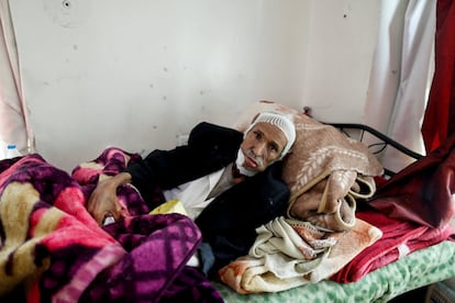 La alianza liderada por Arabia Saudita ha impuesto medidas estrictas sobre el comercio marítimo a Yemen en un esfuerzo por cortar el suministro de armas a los houthis, que todavía controlan las zonas más pobladas del país, incluido Sanaa. Pero las medidas también han ralentizado el flujo de suministros de ayuda que se necesitan desesperadamente. En la imagen, Ali Hizam Mused, de 70 años, sufre cáncer de boca y está alojado en un centro solidario para pacientes de cáncer en Sanaa (Yemen).