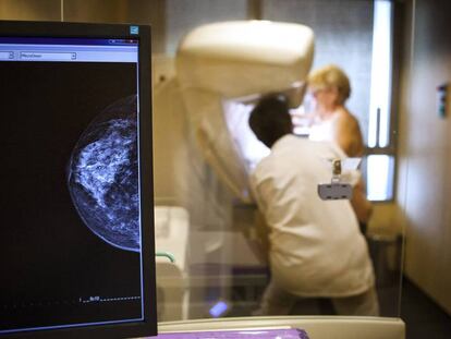 Un técnico realiza una mamografía a una paciente BSIP