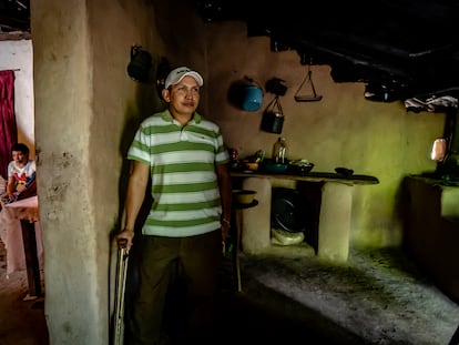 Santiago Seferino Álvarez Álvarez se encuentra en la cocina de su hogar, en la comunidad Matapalo Orocuina, en Honduras, el 26 de julio de 2022. Santiago Álvarez perdió su pierna izquierda durante un accidente de tren en su paso por México al intentar migrar a Estados Unidos. Fue deportado a Honduras en donde  recibió una prótesis de la Fundación Vida Nueva, ubicada en la ciudad de Choluteca y actualmente trabaja en el laboratorio de entomología de la Secretaría de Salud, ubicada en Tegucigalpa. 