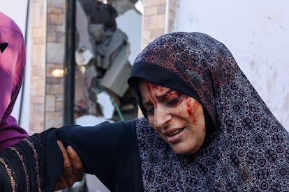 Una mujer palestina herida esperaba ser atendida por los servicios médicos en la ciudad de Rafah, al sur de la franja de Gaza. 