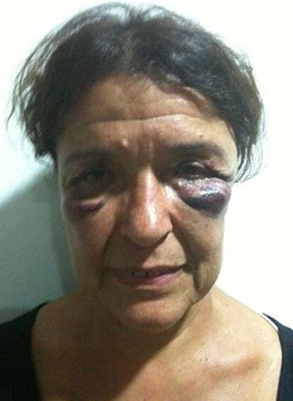 Carmen Roger, una de las activistas agredidas por la policía marroquí, según denuncian desde la organización