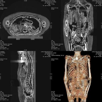 Secciones del cuerpo de Seramón (tronco, corte transversal y longitudinal)