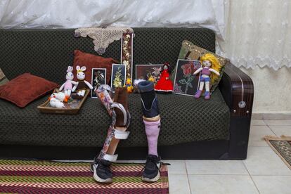 Los cuadros, bandejas y muñecas que hace a mano la siria Raya, de 13 años, junto a sus prótesis de las piernas. Raya sobrevivió a un coche bomba en Damasco, su ciudad natal, en 2014, pero perdió una pierna y la otra quedó destrozada.