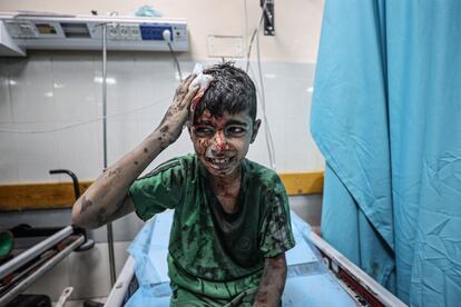 Un niño herido espera para recibir asistencia médica en el hospital Nasser de Jan Yunis, tras un bombardeo israelí, este jueves. 