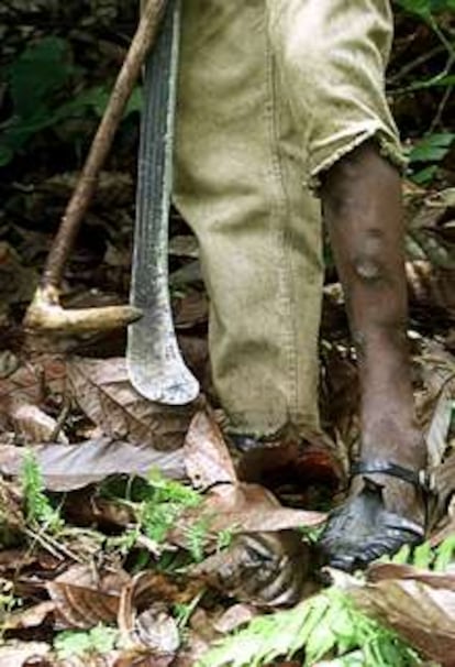 Amadou Kourago, de 15 años , muestra las cicatrices de su pierna provocadas por el machete que utiliza en la recolección de cacao en Costa de Marfil.