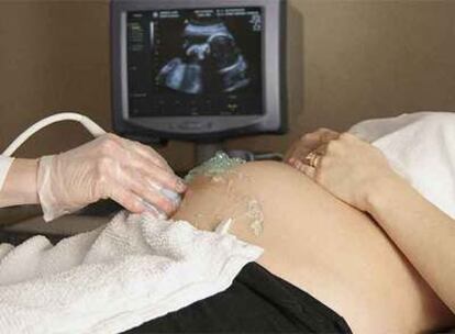 Una mujer embarazada, durante una ecografía.