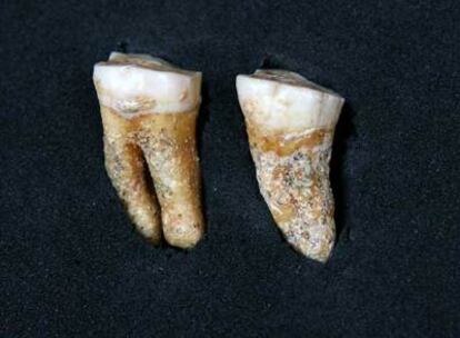 Molares de <i>Homo neanderthalensis</i>.