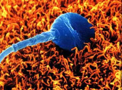 Imagen de un espermatozoide humano intentando fecundar un óvulo.