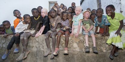 El albinismo es un trastorno genético hereditario que impide que el cuerpo produzca suficiente melanina, para proteger la piel del sol. Según los datos de la OMS, una persona de entre 5.000 a 15.000 en África subsahariana sufre esta condición. Además de los problemas de salud que afrontan por esta carencia de melanina, los albinos y en especial los menores, han estado expuestos a la estigmatización e incluso a rituales de brujería. “No tienen las mismas oportunidades de escolarización y atención médica que las demás. La superstición y las creencias erróneas alimentan este trato desigual”, señalaba Amnistía Internacional en un comunicado en 2016.