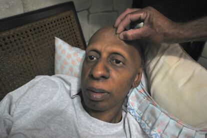 Un médico examina al disidente cubano Guillermo Fariñas, en su domicilio de Santa Clara, en marzo.