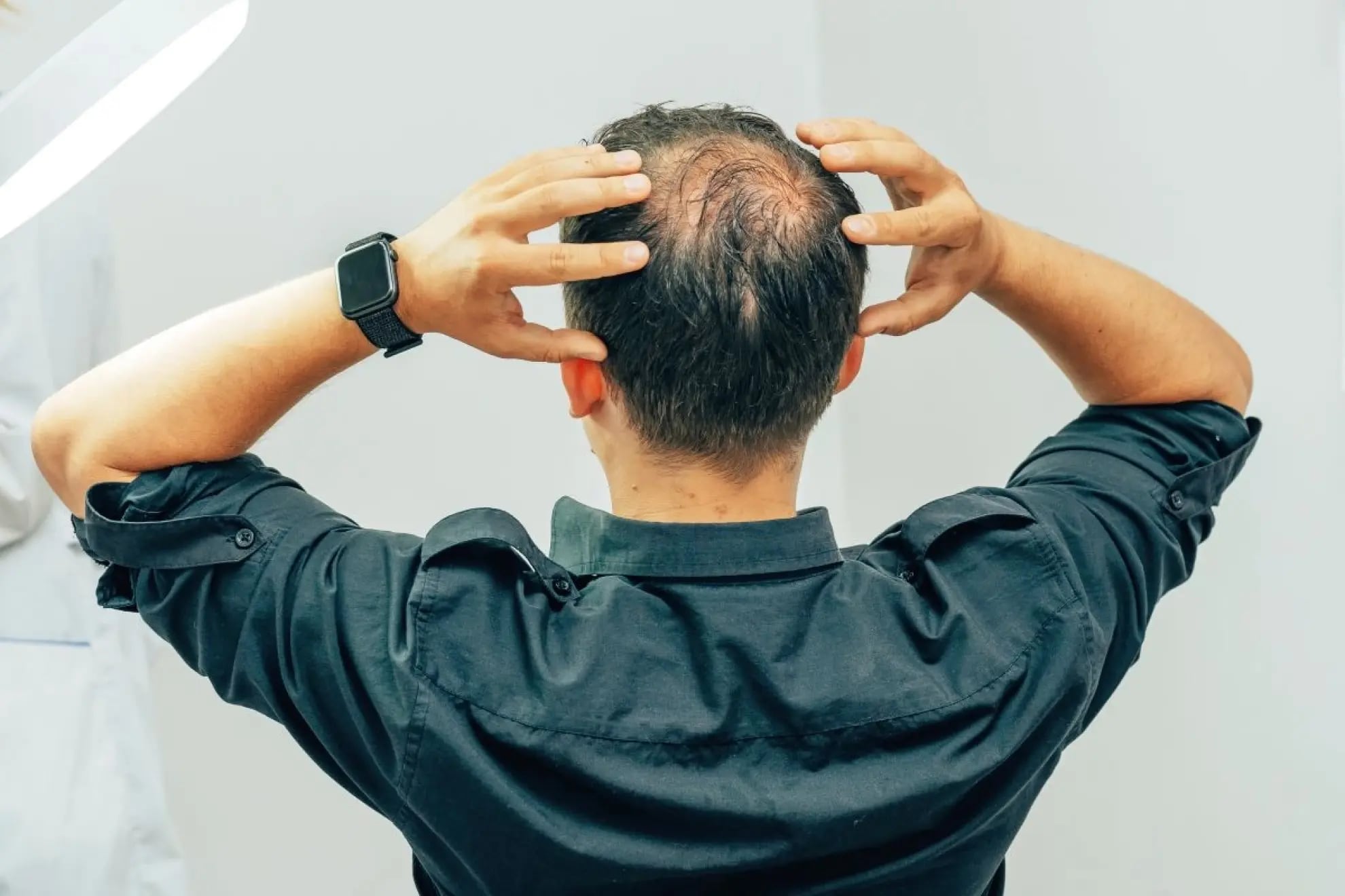 Ni minoxidil ni lociones: el champú que previene la caída del cabello y causa furor entre los usuarios
