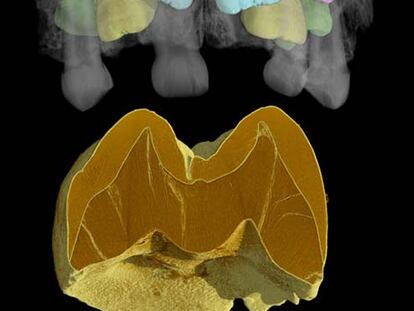 Tomografía de una mandíbula neandertal.