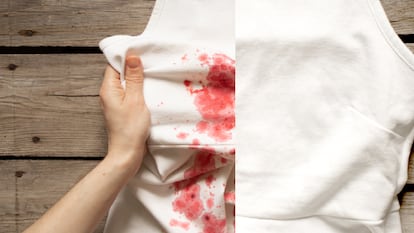 Cómo quitar mancha de sangre en la ropa