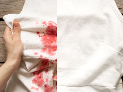 Cómo quitar mancha de sangre en la ropa