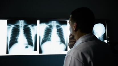 Male doctor at work in public medical clinic and examining x-ray plates of bones, skull and lungs