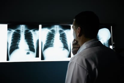 Male doctor at work in public medical clinic and examining x-ray plates of bones, skull and lungs